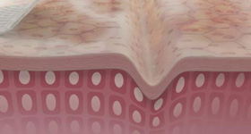 细胞壁医学演绎 MG动画