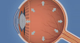 眼部医学动画  MG动画