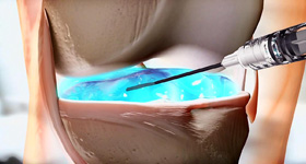 医用医疗器械动画  MG动画